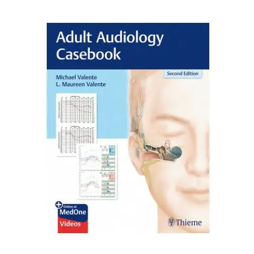 Adult audiology casebook Thieme medical publishers inc