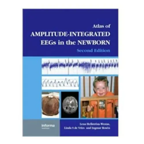 An Atlas of Amplitude-Integrated EEGs in the Newborn, Second Edition