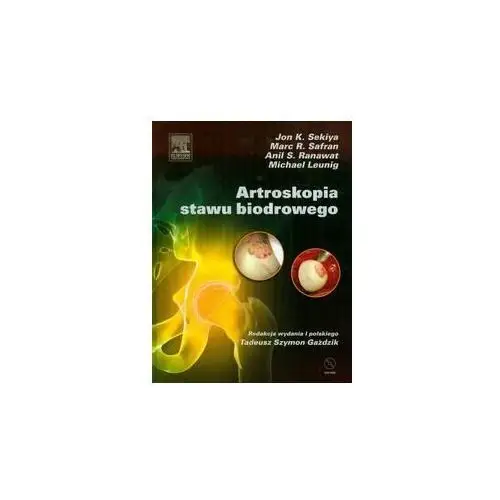 Artroskopia stawu biodrowego + CD