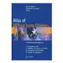 Atlas of Diffuse Lung Diseases Sklep on-line