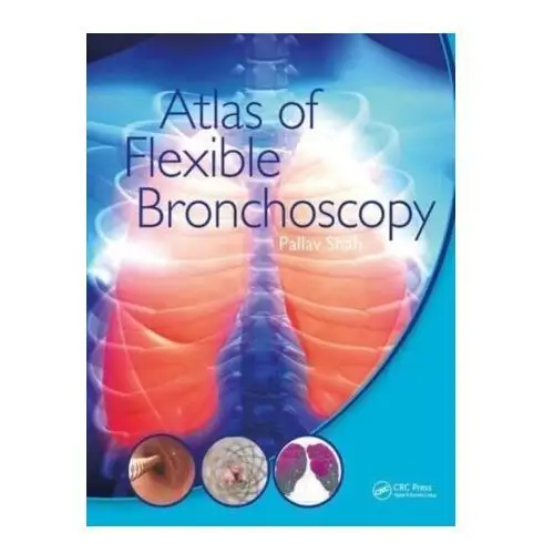 Atlas of Flexible Bronchoscopy Shah, Pallav L (MD, MBBS, FRCP, Consultant Physician, Royal Brompton Hospital and Chelsea and Westminster Hospital, Lond