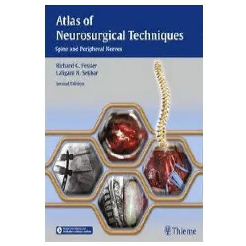 Atlas of Neurosurgical Techniques