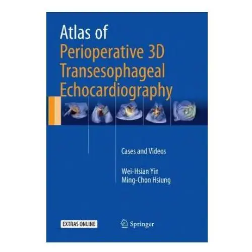 Atlas of perioperative 3d transesophageal echocardiography Springer verlag, singapore