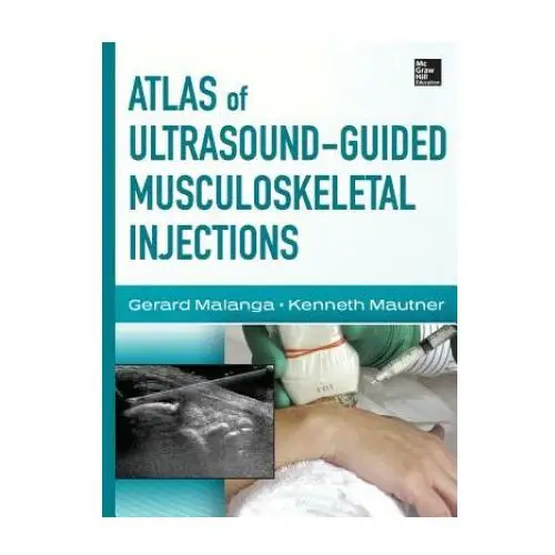 Atlas of ultrasound-guided musculoskeletal injections Mcgraw-hill education - europe