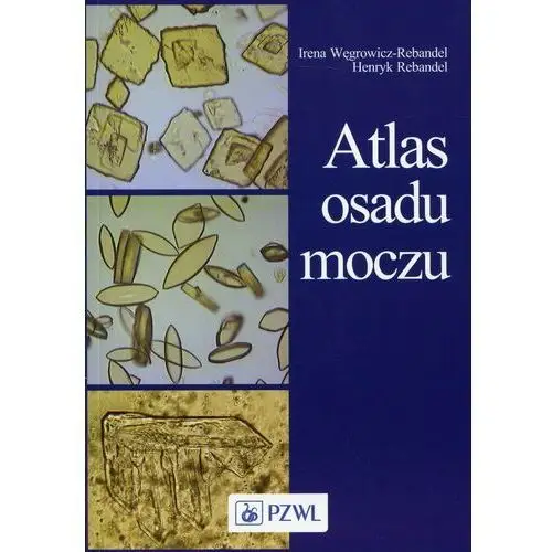 Atlas osadu moczu