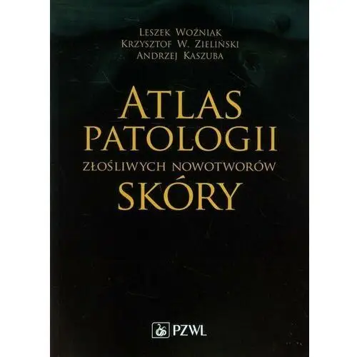 Atlas patologii złośliwych nowotworów skóry