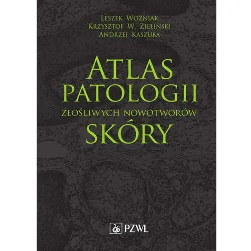 Atlas patologii złośliwych nowotworów skóry, AZ#3B448300EB/DL-ebwm/epub