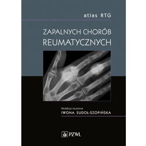 Atlas RTG zapalnych chorób reumatycznych