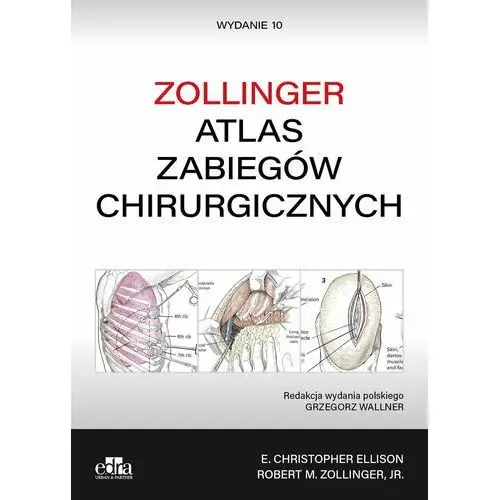 Atlas zabiegów chirurgicznych. Zollinger