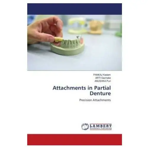 Attachments in Partial Denture