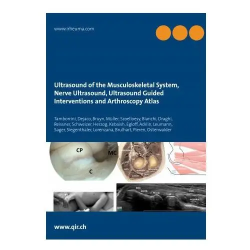 Books on demand Ultrasound of the musculoskeletal system, nerve ultrasound, ultrasound guided interventions and arthroscopy atlas