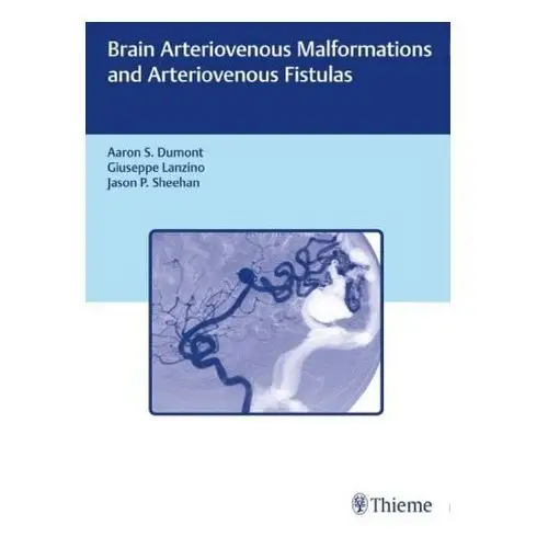 Brain Arteriovenous Malformations and Arteriovenous Fistulas Dumont, Aaron S