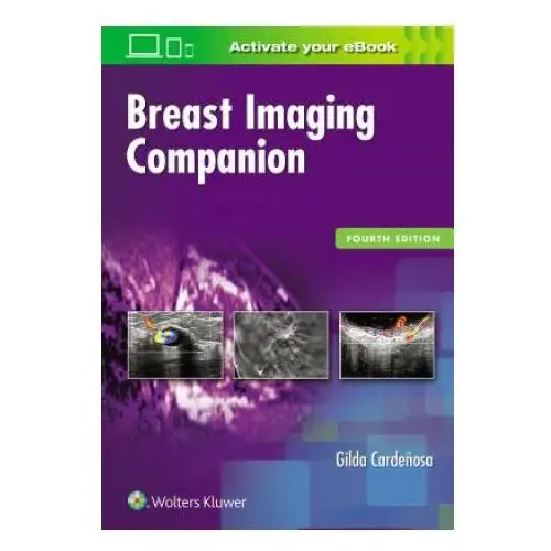 Breast imaging companion Lippincott williams and wilkins