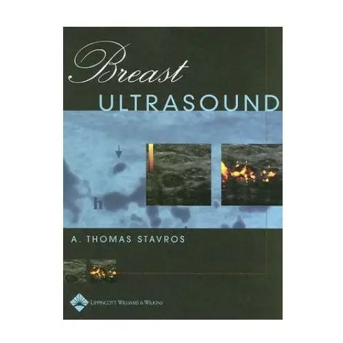 Breast Ultrasound