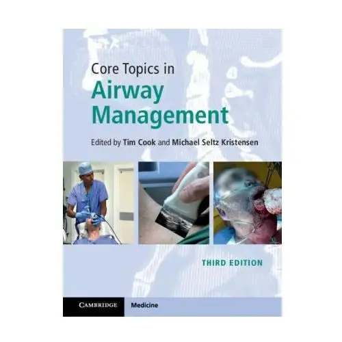 Cambridge university press Core topics in airway management