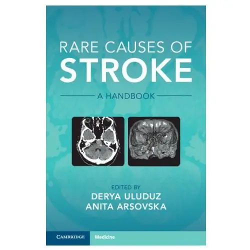 Cambridge university press Rare causes of stroke