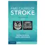 Cambridge university press Rare causes of stroke Sklep on-line
