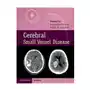 Cerebral small vessel disease Cambridge university press Sklep on-line