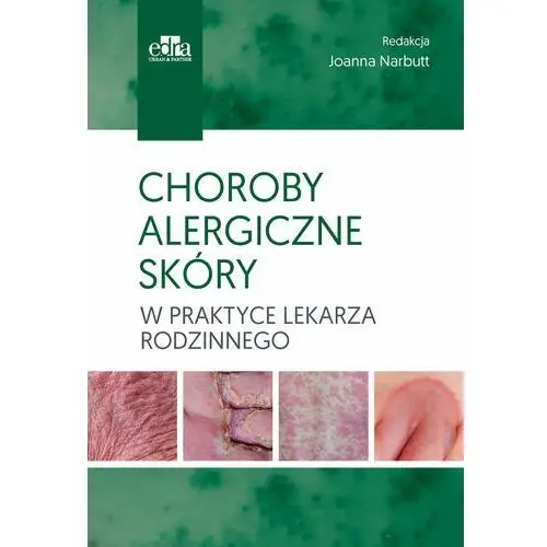 Choroby alergiczne skóry w praktyce lekarza rodzinnego