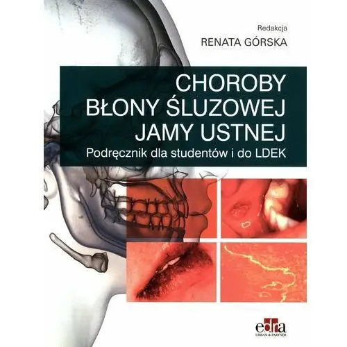 Choroby błony śluzowej jamy ustnej