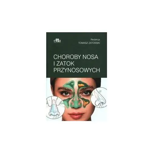 Choroby nosa i zatok przynosowych