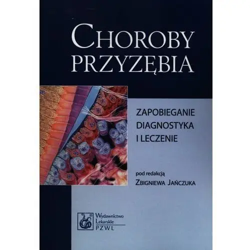 Choroby przyzębia