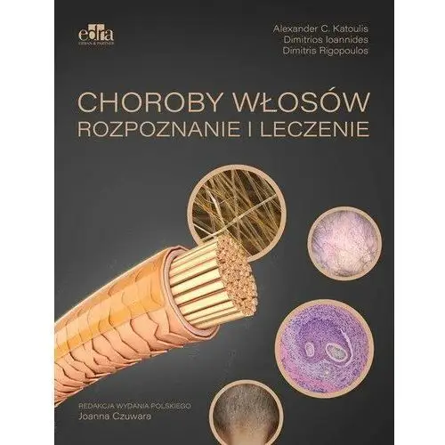 Choroby włosów. Rozpoznanie i leczenie