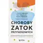 Choroby zatok przynosowych Sklep on-line