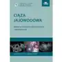 Ciąża jajowodowa. Aktualne możliwości diagnostyczne i terapeutyczne Sklep on-line