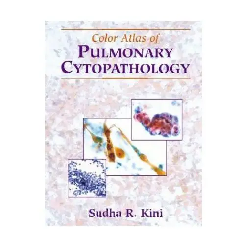 Color Atlas of Pulmonary Cytopathology