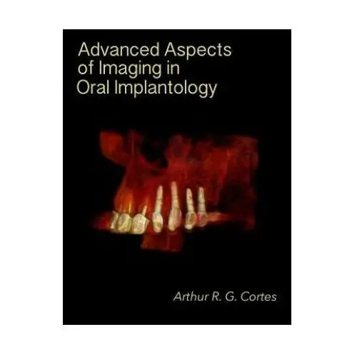 Createspace independent publishing platform Advanced aspects of imaging in oral implantology