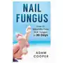 Createspace independent publishing platform Nail fungus: how to naturally cure nail fungus in 30 days: natural remedies, homeopathy for toenail fungus Sklep on-line