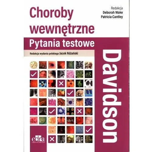 Davidson Choroby wewnętrzne. Pytania testowe