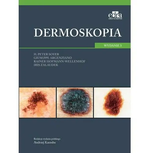 Dermoskopia