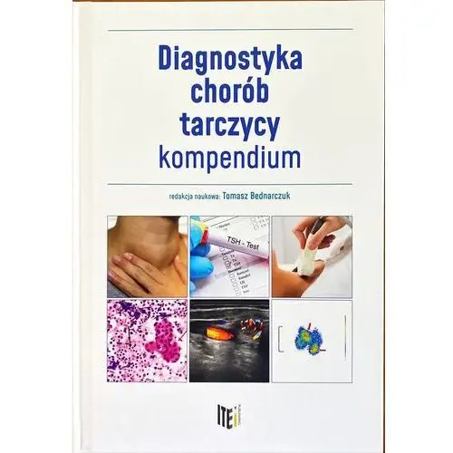 Diagnostyka chorób tarczycy. Kompendium