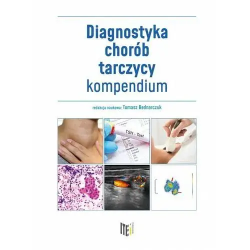 Diagnostyka chorób tarczycy. Kompendium