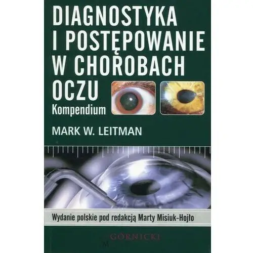 Diagnostyka i postępowanie w chorobach oczu Terry Hayes