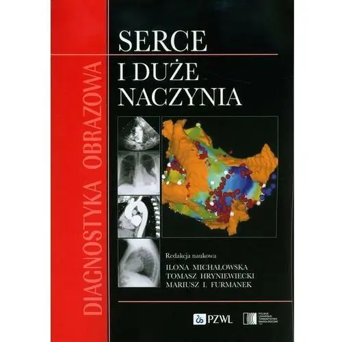 Diagnostyka obrazowa Serce i duże naczynia