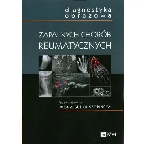 Diagnostyka obrazowa zapalnych chorób reumatycznych