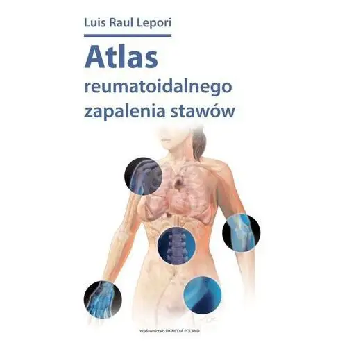 Atlas reumatoidalnego zapalenia stawów Dk media