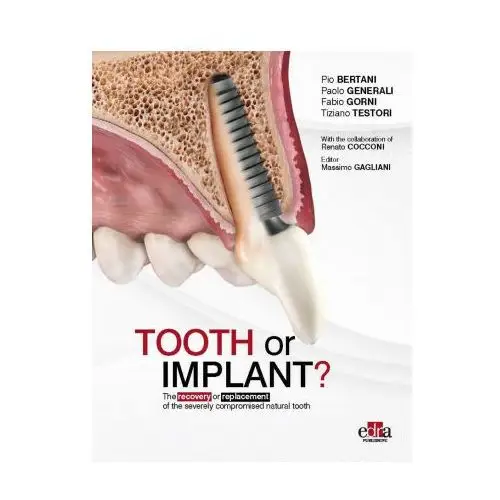 Tooth or implant? the recovery or replacement of the severely compormised natural tooth Edra