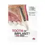 Tooth or implant? the recovery or replacement of the severely compormised natural tooth Edra Sklep on-line