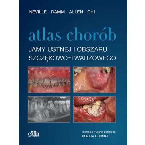 Edra urban & partner Atlas chorób jamy ustnej i obszaru szczękowo-twarzowego