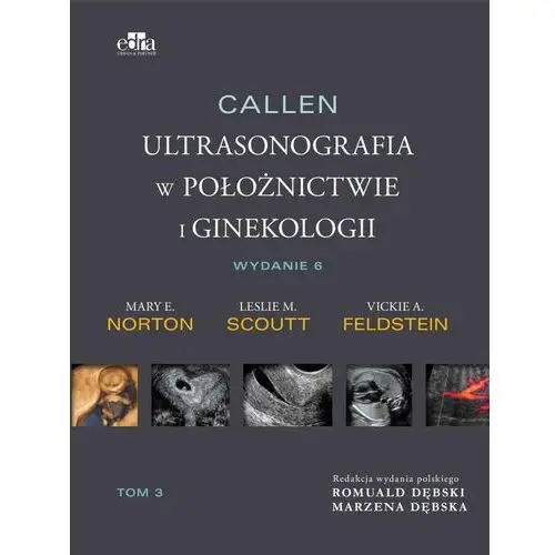 Callen. ultrasonografia w położnictwie i ginekologii. tom 3 Edra urban & partner
