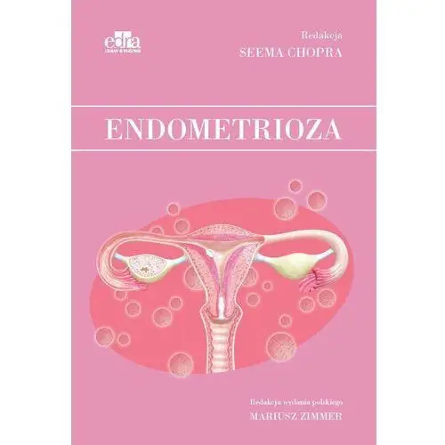 Endometrioza Edra urban & partner