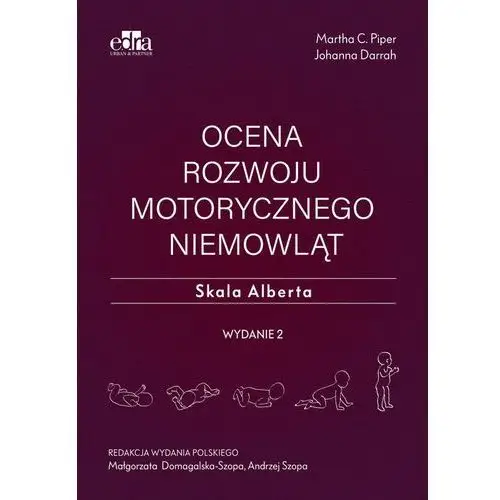 Ocena rozwoju motorycznego niemowląt. Skala Alberta