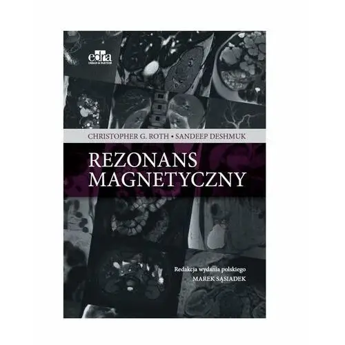 Rezonans Magnetyczny. Jama Brzuszna I Miednica Od 173,25 Zł Opinie ...