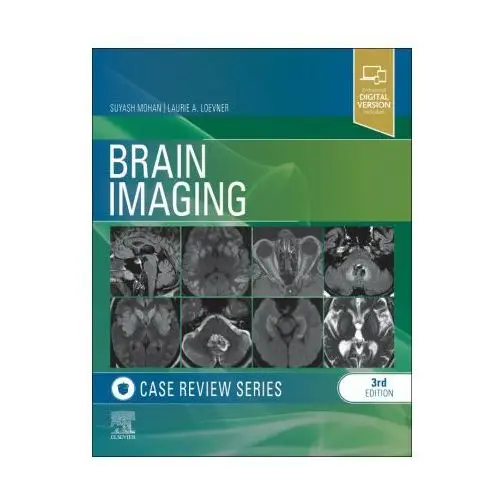 Brain Imaging