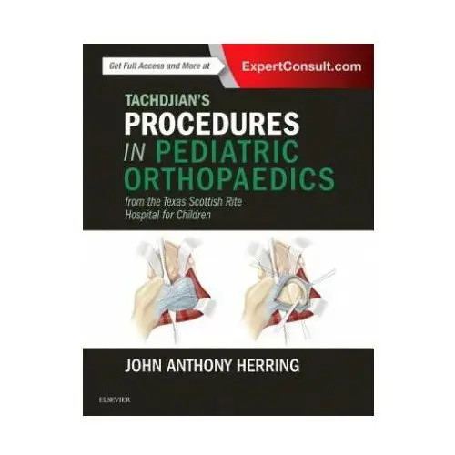 Elsevier books Tachdjian's procedures in pediatric orthopaedics