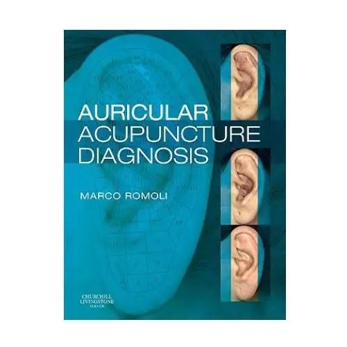 Auricular acupuncture diagnosis Elsevier health sciences